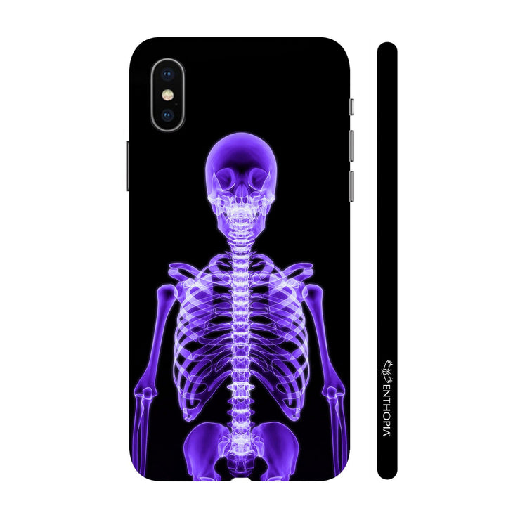Hardshell Phone Case - X-Ray Yourself - Enthopia